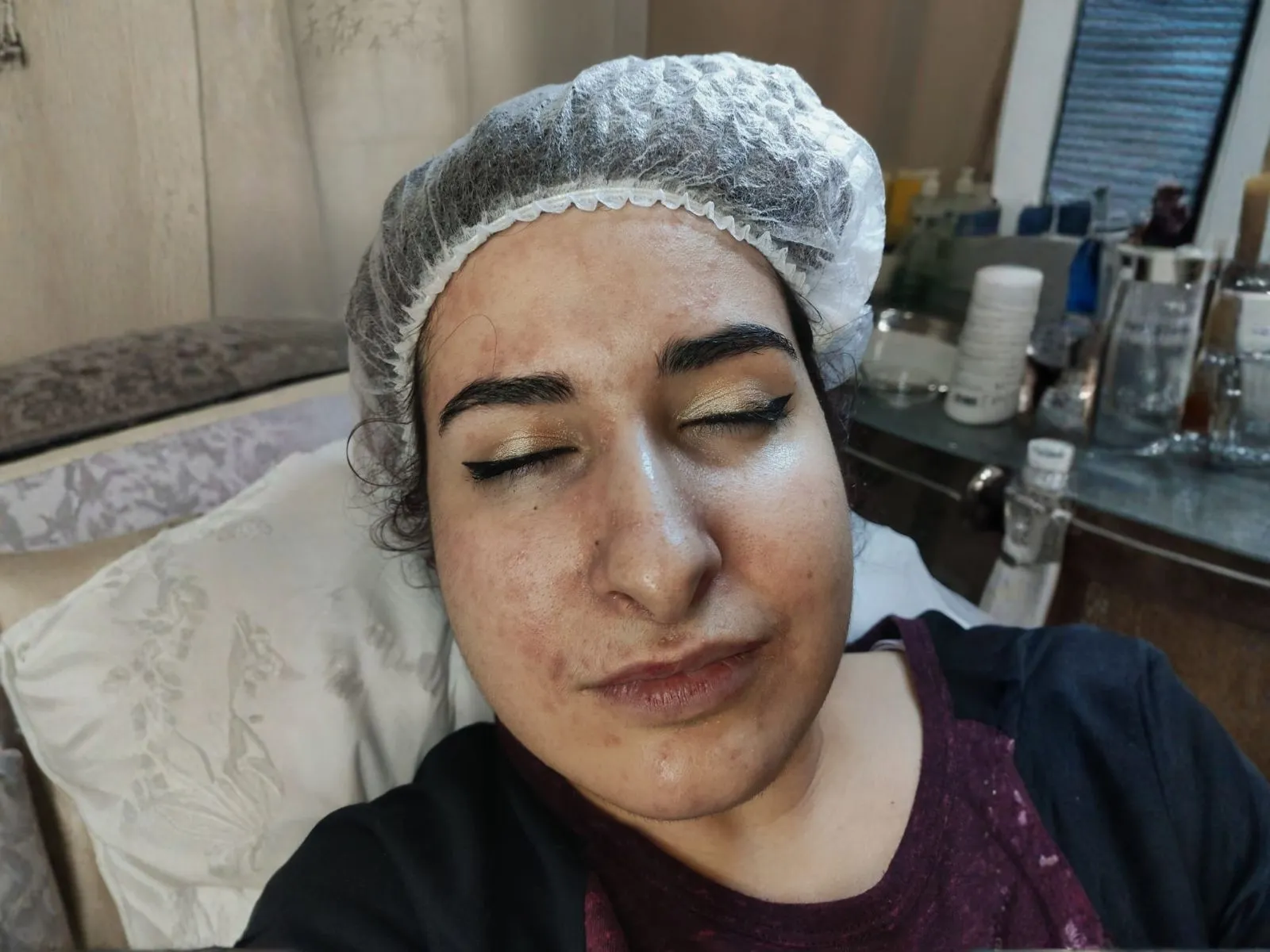 tratamiento facial regenerador , Cromoterapia más cura de hidratación antes